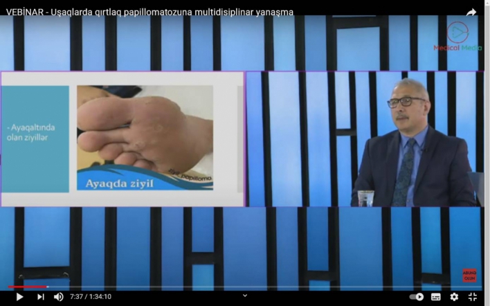 23 апреля состоялся международный вебинар о папилломатозе гортани 4