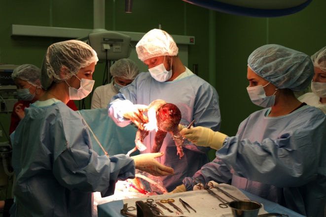 В Перинатальном центре Педиатрического университета приняли роды у женщины с единственной донорской почкой