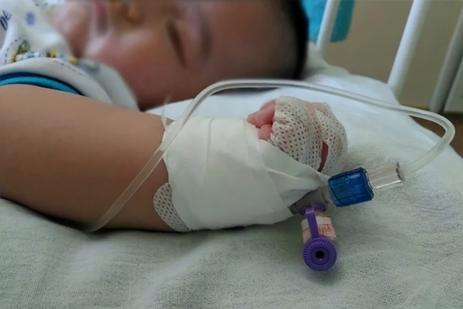 Врачи Педиатрического университета диагностировали у девочки из Адыгеи редкий синдром Херлина-Вернера-Вундерлиха