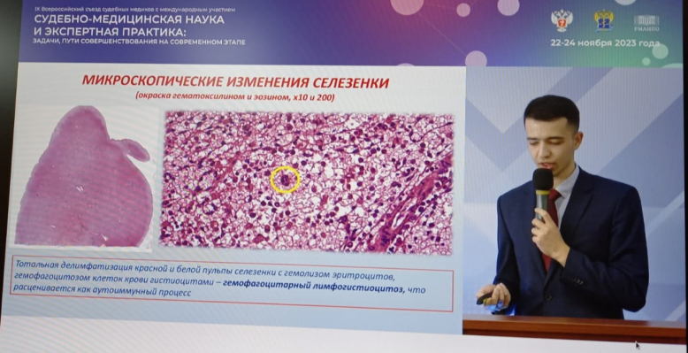 Доклад студента Педиатрического университета признали лучшим в молодёжной секции Всероссийского съезда судебных медиков 1