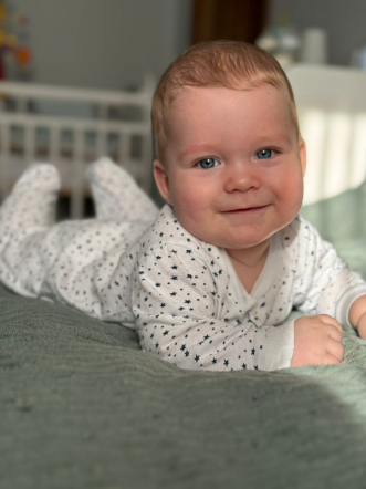 «Об операции напоминает только шрам»: мама пациентки рассказала, как развивается девочка, которую спасли врачи Педиатрического университета 1