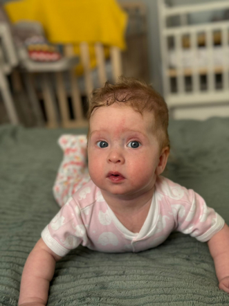 «Об операции напоминает только шрам»: мама пациентки рассказала, как развивается девочка, которую спасли врачи Педиатрического университета 2