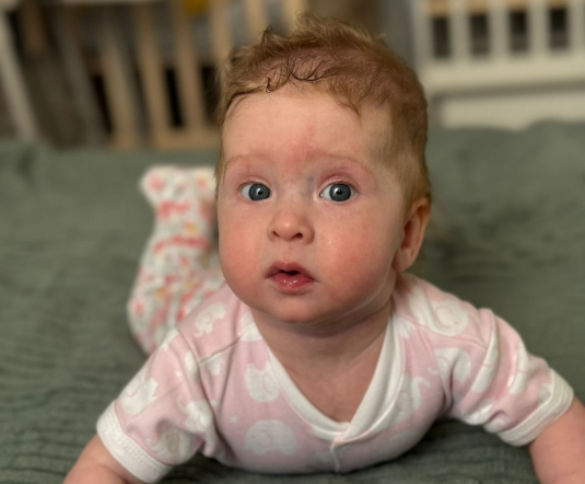 «Об операции напоминает только шрам»: мама пациентки рассказала, как развивается девочка, которую спасли врачи Педиатрического университета