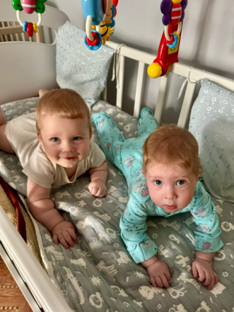 «Об операции напоминает только шрам»: мама пациентки рассказала, как развивается девочка, которую спасли врачи Педиатрического университета 3