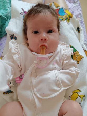 Из клиники Педиатрического университета выписывают девочку, которой врачи в апреле удалили гигантскую опухоль 5