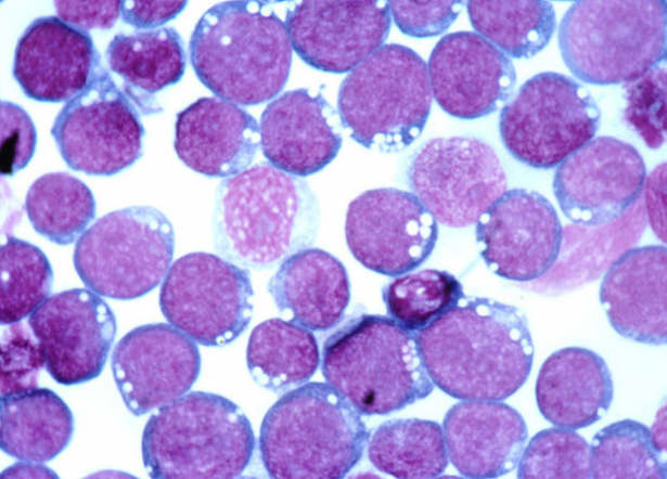 В Педиатрическом университете изучают, как вирус Эпштейна-Барр влияет на щитовидную железу и гипофиз у детей в разные периоды заболевания