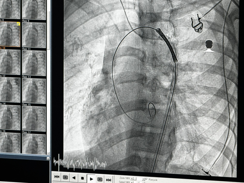 Дмитрий Иванов: «Успех такой операции возможен только при взаимодействии большого количества специалистов высочайшего уровня» 3